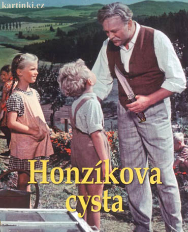 Honz�kova cysta